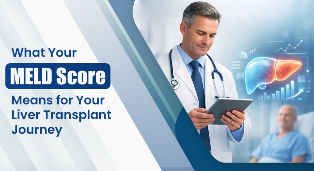 What Your MELD Score Means for Your Liver Transplant Eligibility?