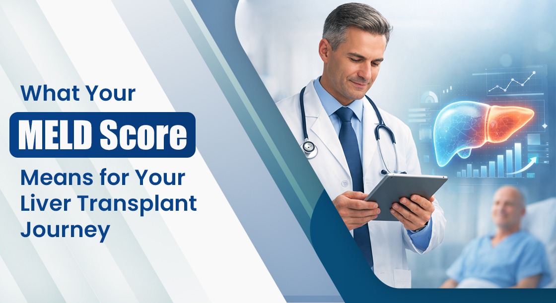 What Your MELD Score Means for Your Liver Transplant Eligibility?